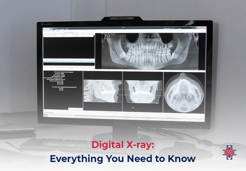 Digital X Ray - Everything You Need to Know | ER of Mesquite - Emergency Room