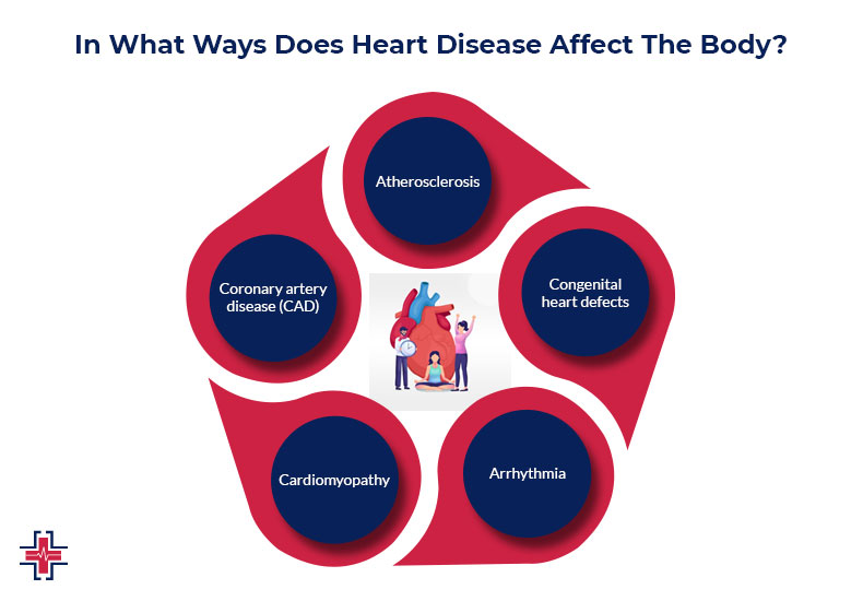 In What Ways Does Heart Disease Affect The Body | ER of Mesquite - Emergency Room