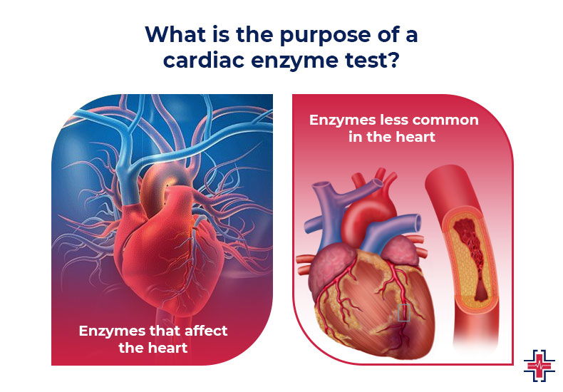 What is the Purpose of a Cardiac Enzyme Test | ER of Mesquite - Emergency Room