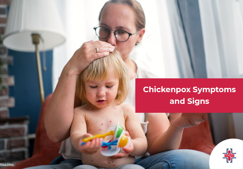 Chickenpox - Symptoms and Signs | ER of Mesquite