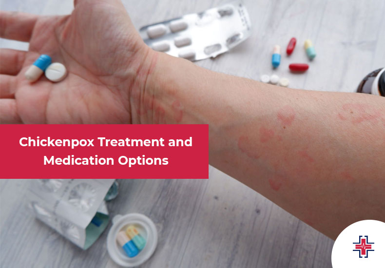 Chickenpox - Treatment and Medication Options - ER of Mesquite