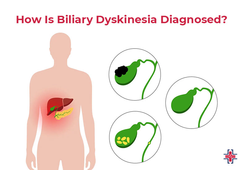 How Is Biliary Dyskinesia Diagnosed - ER of Mesquite