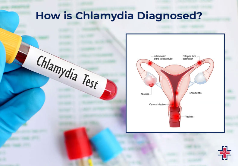 How is Chlamydia Diagnosed - ER of Mesquite