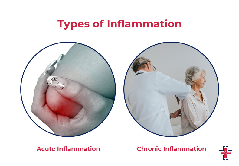 Types of Inflammation - ER of Mesquite