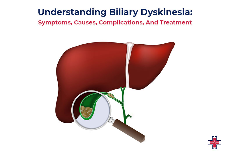 Understanding Biliary Dyskinesia - Symptoms, Causes, Complications And Treatment - ER of Mesquite
