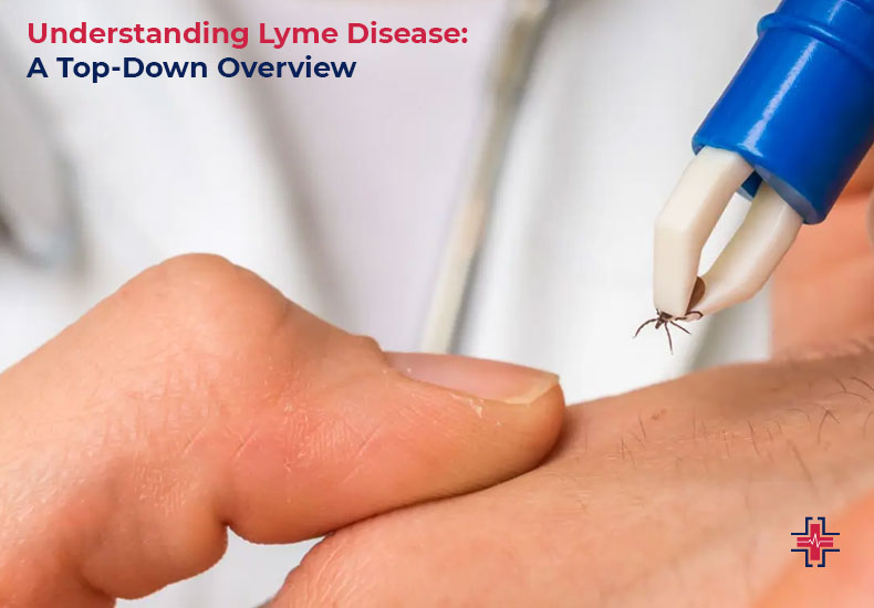 Understanding Lyme Disease - A Top Down Overview - ER of Mesquite