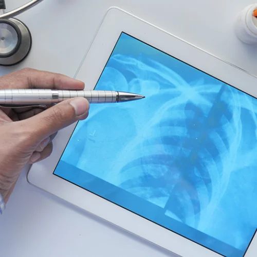 What-is-Digital-X-rays