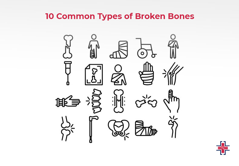 10 Common Types of Broken Bones - ER of Mesquite