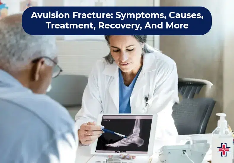 Avulsion Fracture - Symptoms, Causes, Treatment, Recovery - ER of Mesquite