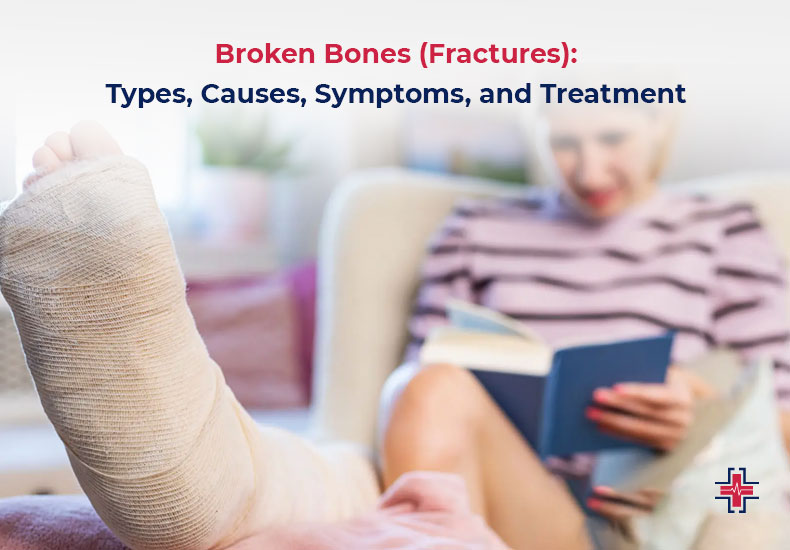 Broken Bones (Fractures) - Types, Causes, Symptoms and Treatment - ER of Mesquite