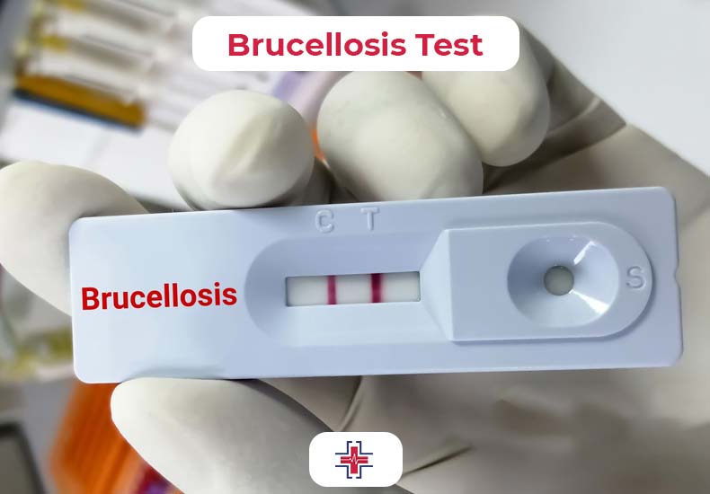 Brucellosis Test - ER of Mesquite