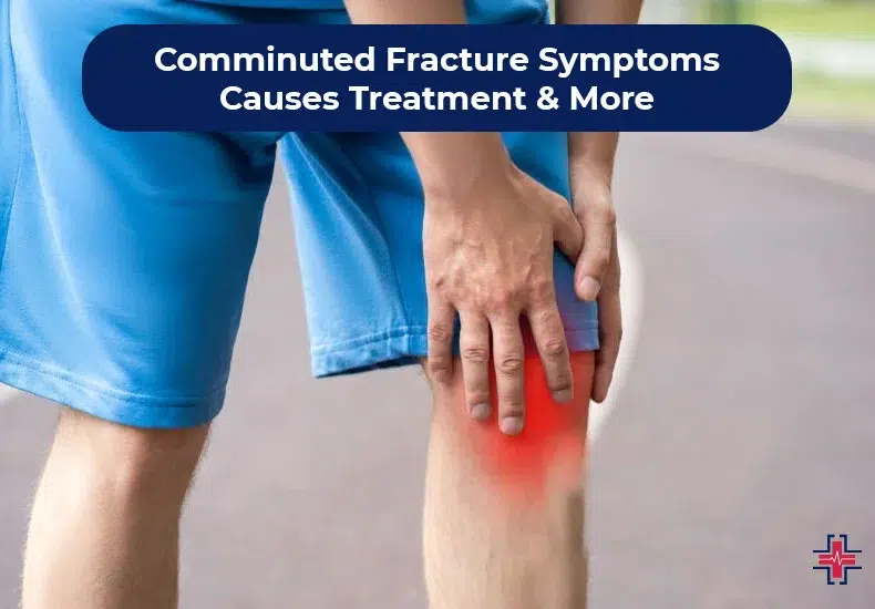 Comminuted Fracture - Symptoms, Causes, Treatment and More - ER of Mesquite