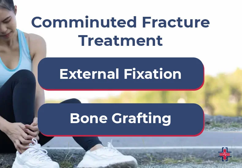 Comminuted Fracture Treatment - ER of Mesquite