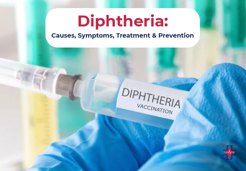 Diphtheria - Causes, Symptoms, Treatment, Prevention - ER of Mesquite