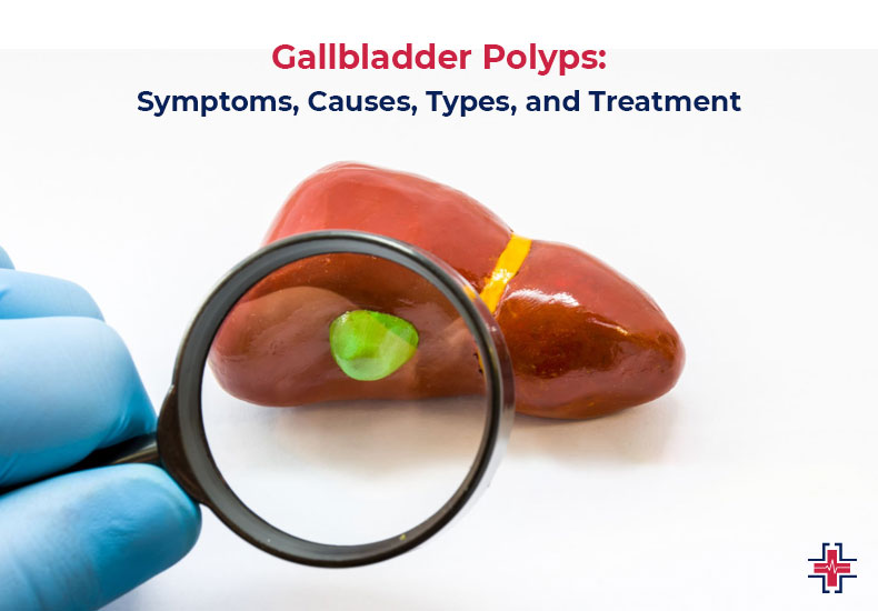 Gallbladder Polyps - Symptoms, Causes, Types, and Treatment - ER of Mesquite