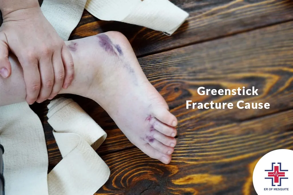 Greenstick Fracture Cause - ER of Mesquite