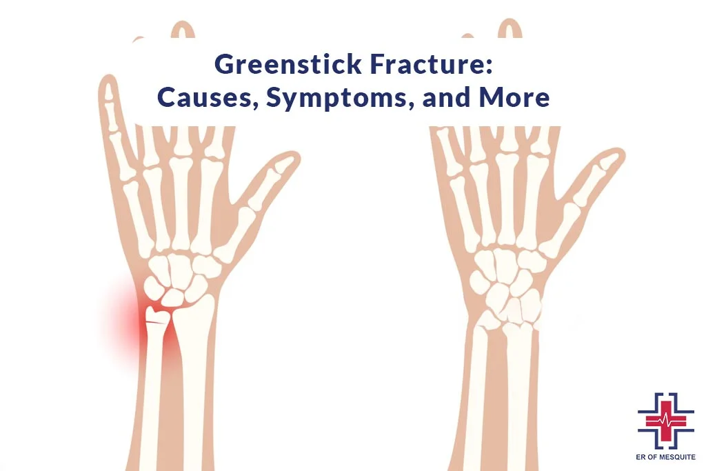 Greenstick Fracture - Causes, Symptoms and Treatment - ER of Mesquite