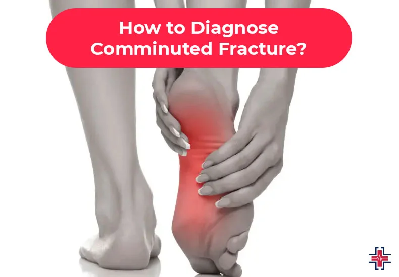 How to Diagnose Comminuted Fracture - ER of Mesquite