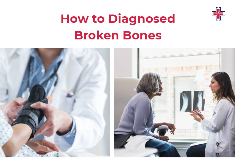 How to Diagnosed Broken Bones - ER of Mesquite