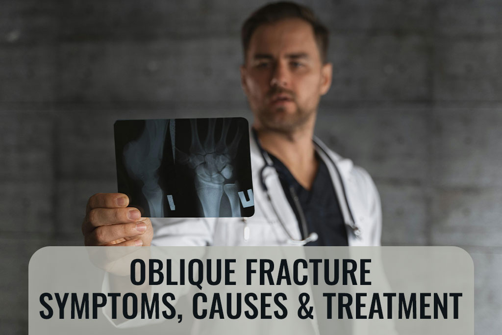 Oblique Fracture - Symptoms, Causes & Treatment - ER of Mesquite