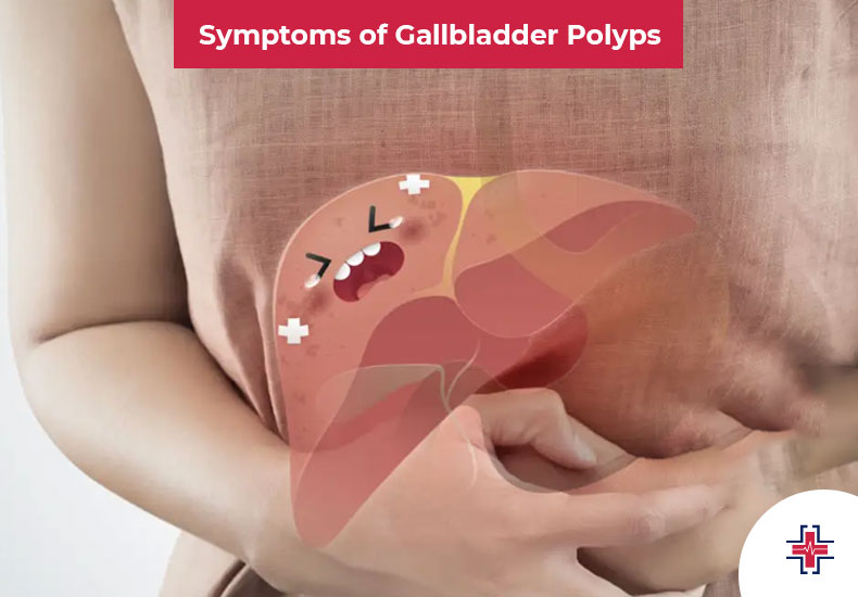 Symptoms of Gallbladder Polyps - ER of Mesquite