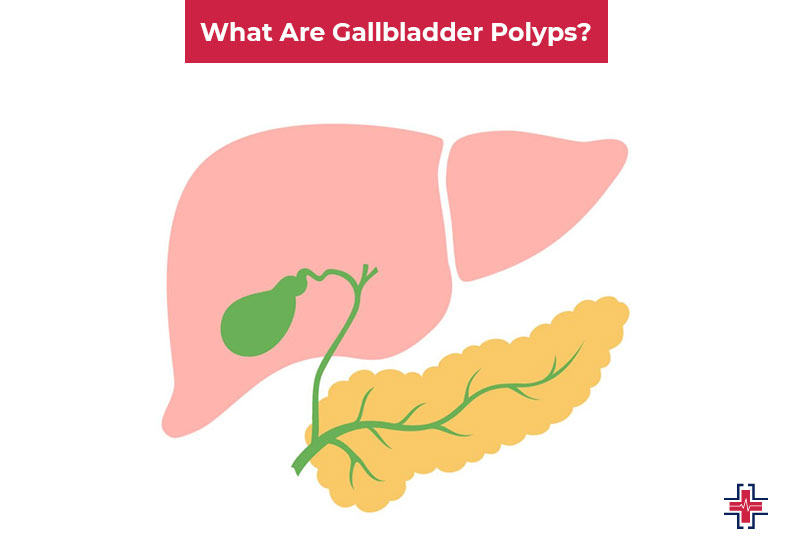 What Are Gallbladder Polyps - ER of Mesquite