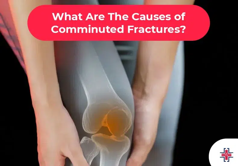 What Are The Causes of Comminuted Fractures - ER of Mesquite