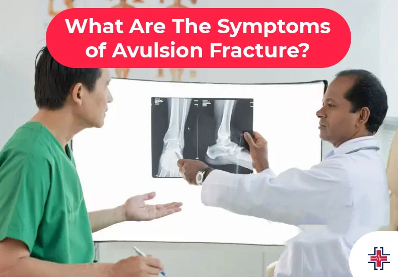 What Are The Symptoms of Avulsion Fracture - ER of Mesquite
