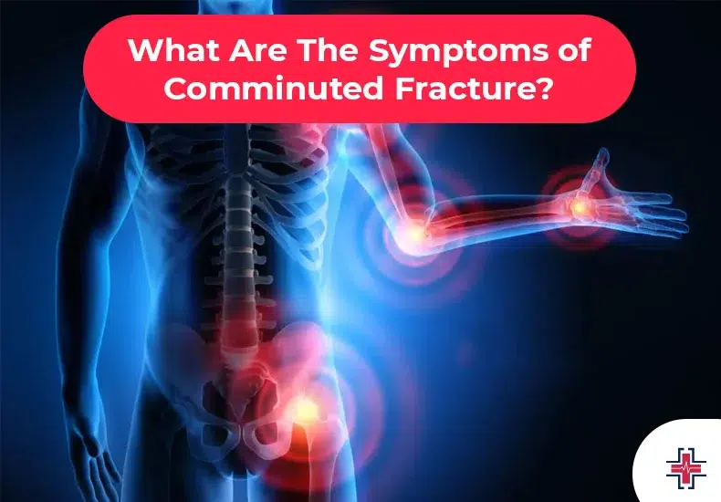 What Are The Symptoms of Comminuted Fracture - ER of Mesquite