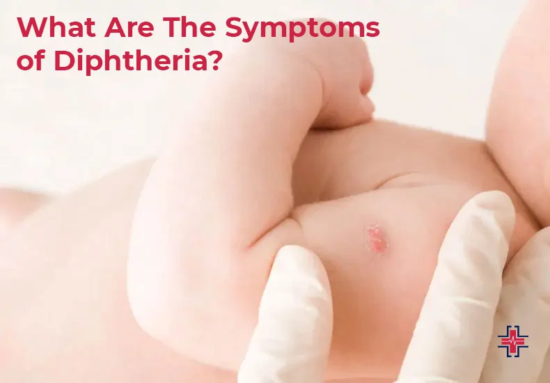What Are The Symptoms of Diphtheria - ER of Mesquite