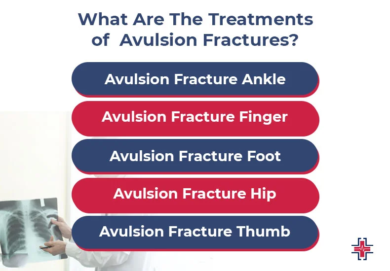 What Are The Treatments of Avulsion Fractures - ER of Mesquite