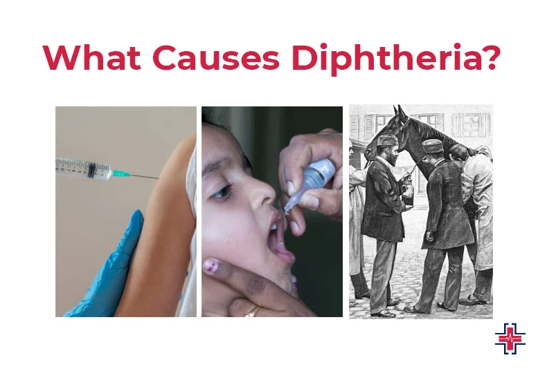 What Causes Diphtheria - ER of Mesquite