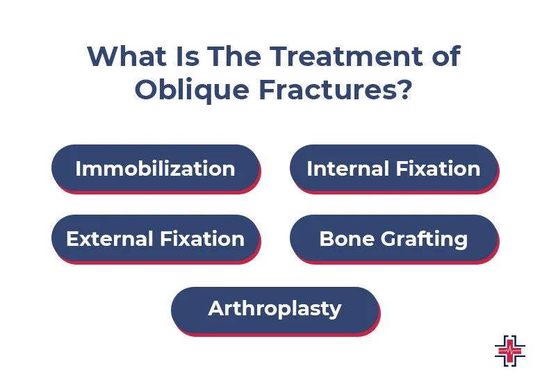 What Is The Treatment of Oblique Fractures - ER of Mesquite