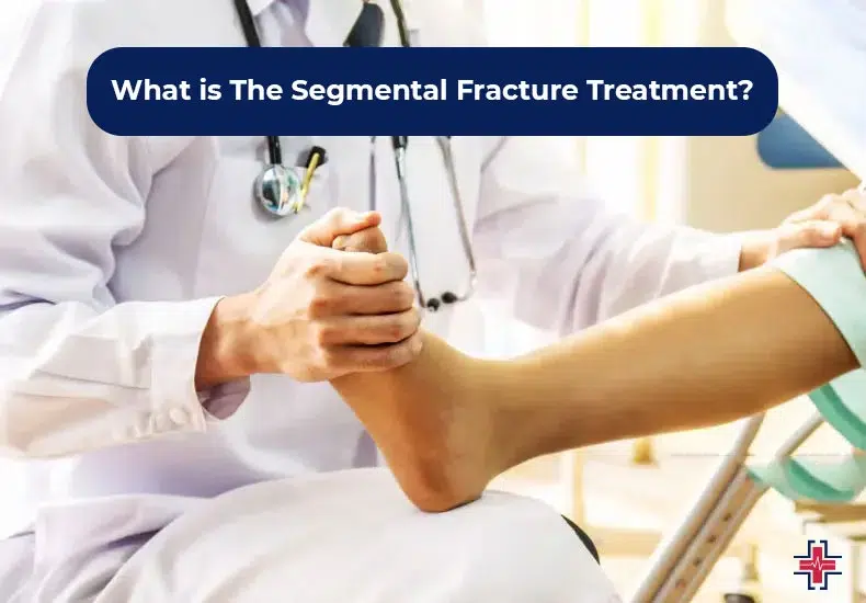 What is The Segmental Fracture Treatment - ER of Mesquite