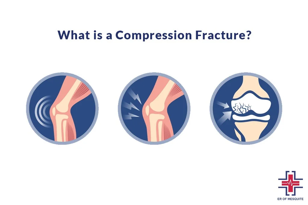 What is a Compression Fracture - ER of Mesquite