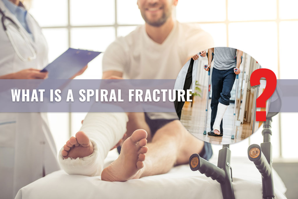 What is a Spiral Fracture - ER of Mesquite
