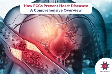 How ECGs Prevent Heart Diseases - A Comprehensive Overview - ER of Mesquite
