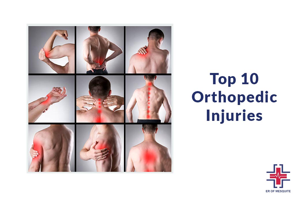 Top 10 Orthopedic Injuries - ER of Mesquite