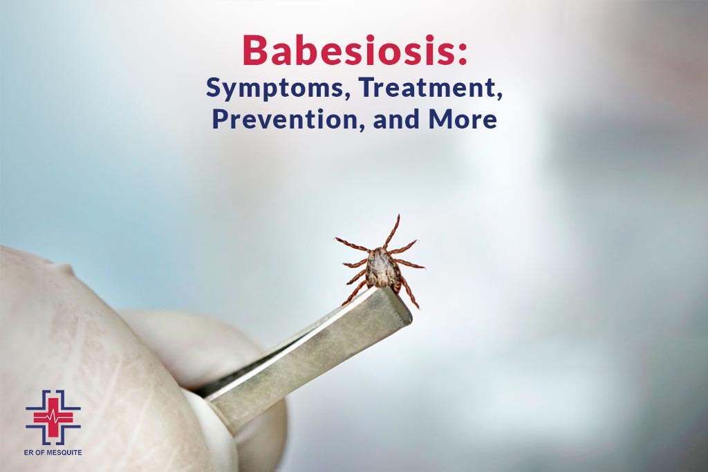 Babesiosis - Symptoms, Treatment, Prevention and More - ER of Mesquite