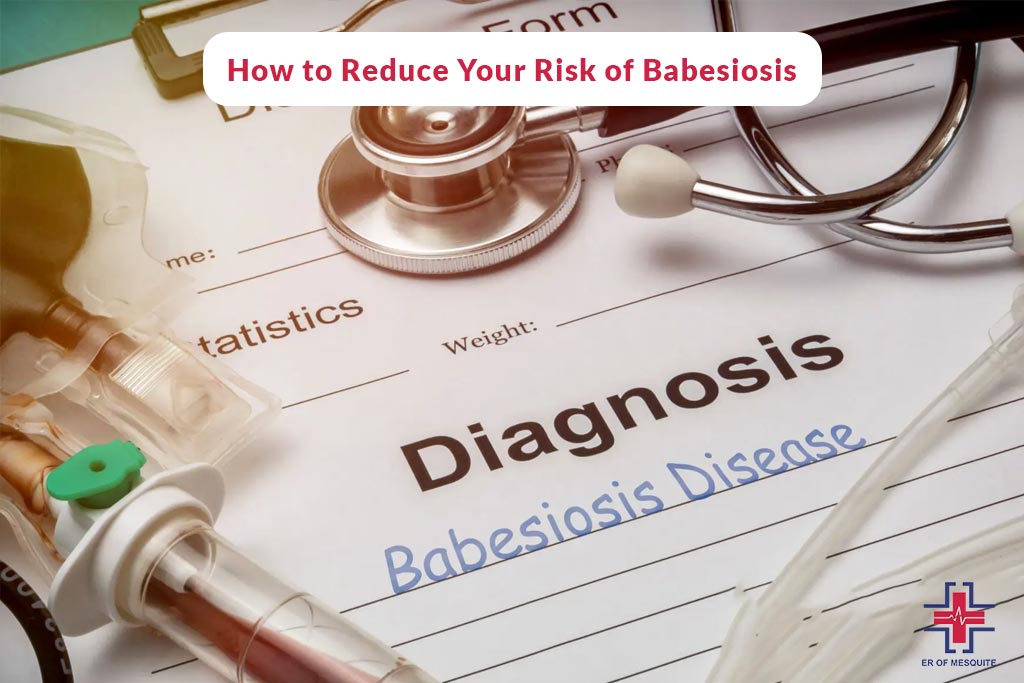 How to Reduce Your Risk of Babesiosis - ER of Mesquite