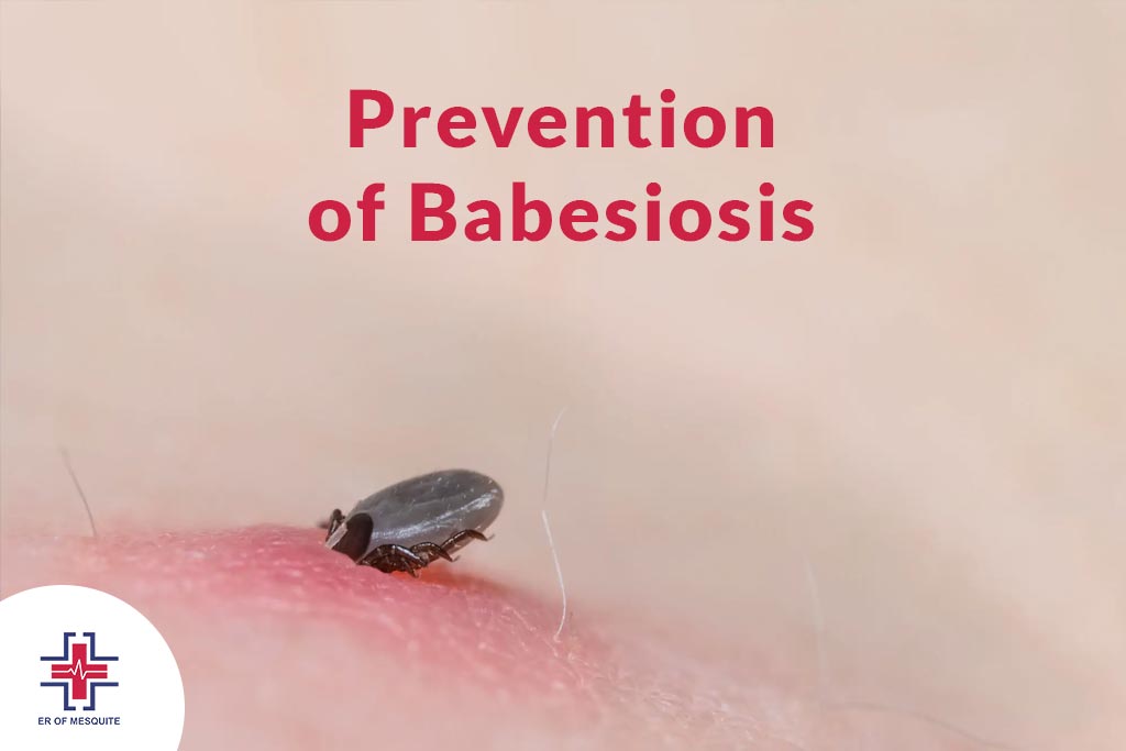 Prevention of Babesiosis - ER of Mesquite