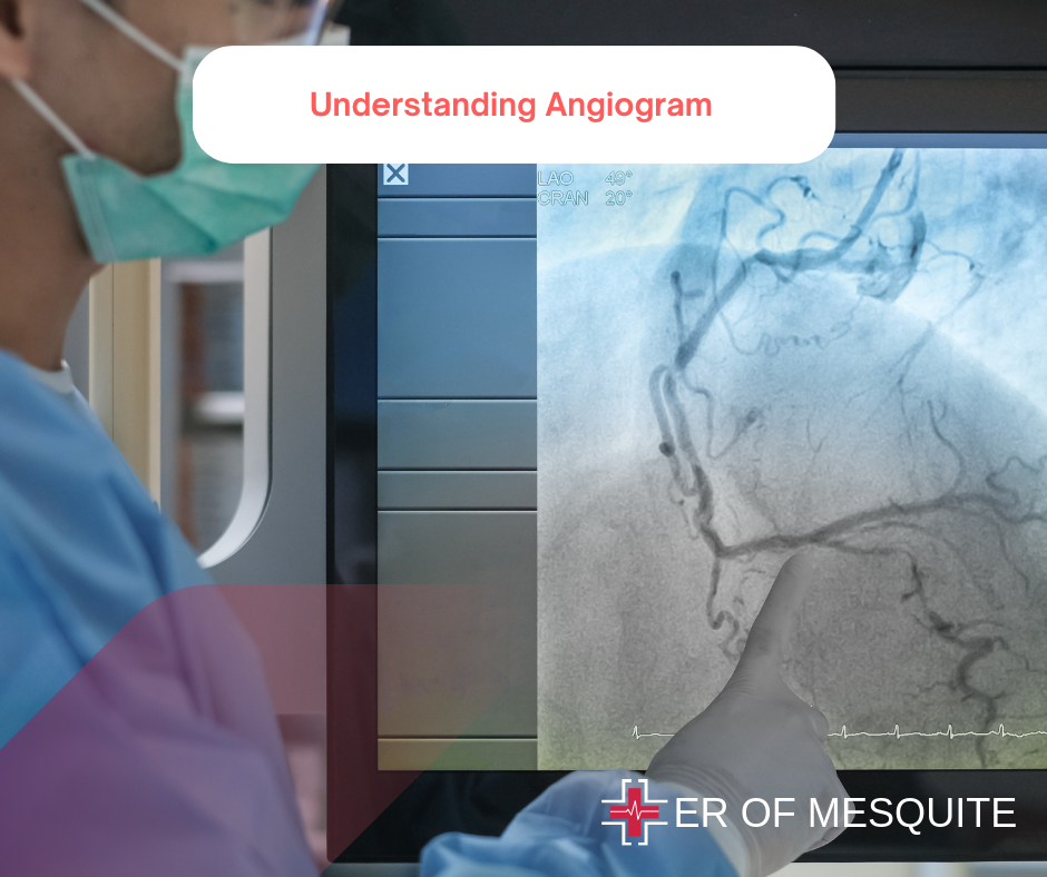 Understanding Angiogram ER of Mesquite