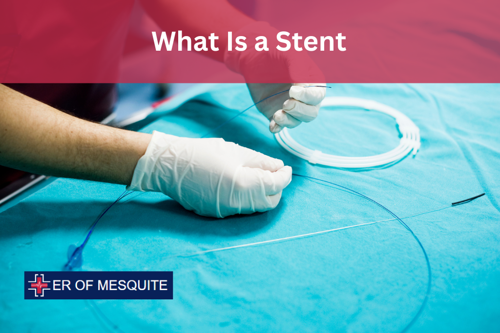 What Is a Stent? - ER of Mesquite