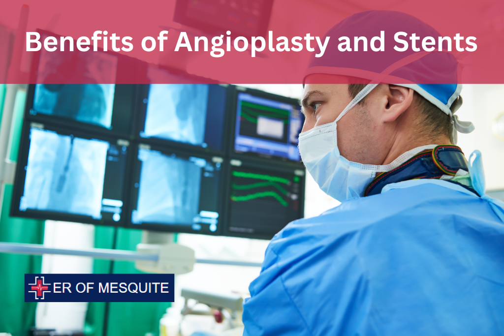 Benefits of Angioplasty and Stents - ER of Mesquite