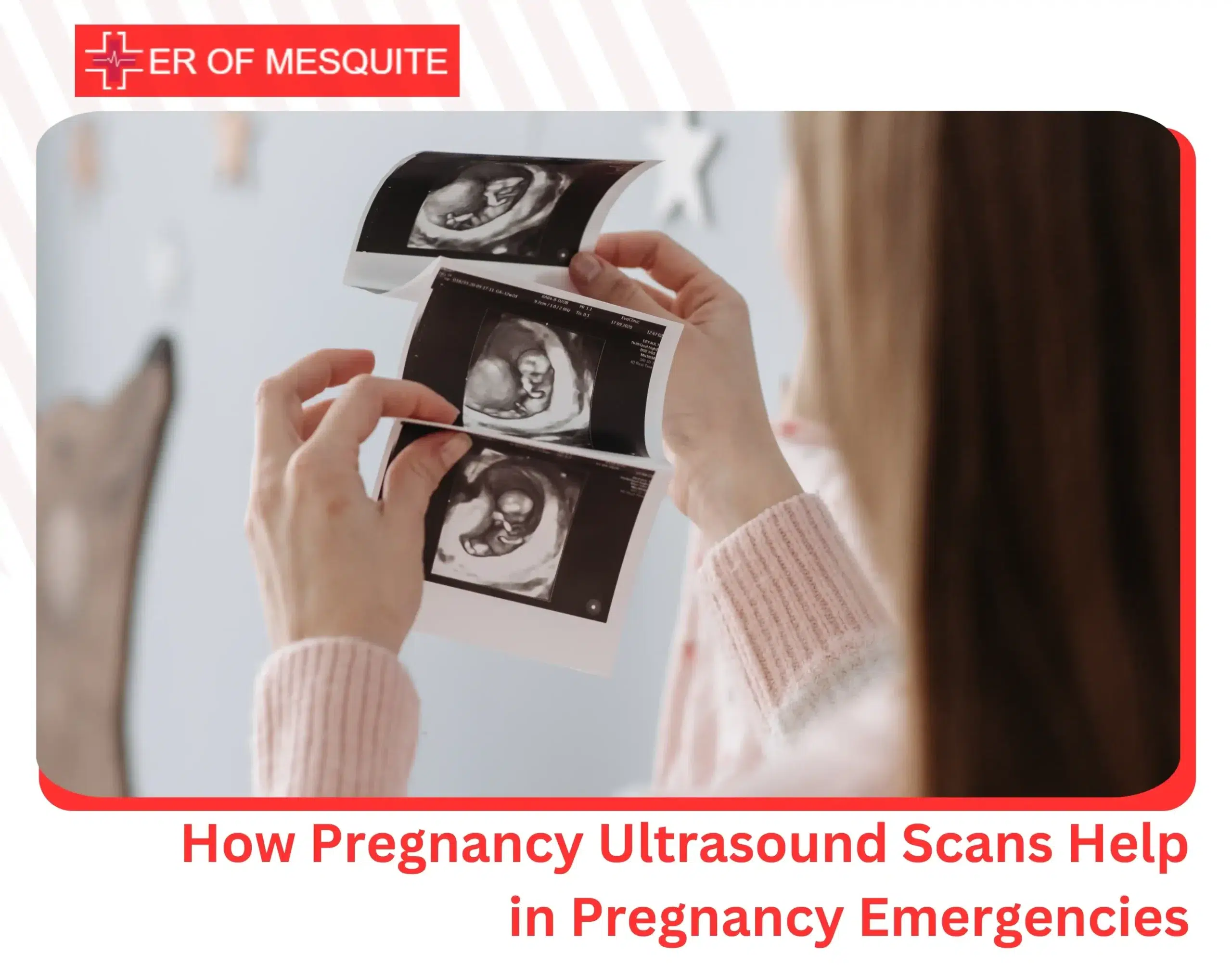 How Pregnancy Ultrasound Scans Help in Pregnancy Emergencies