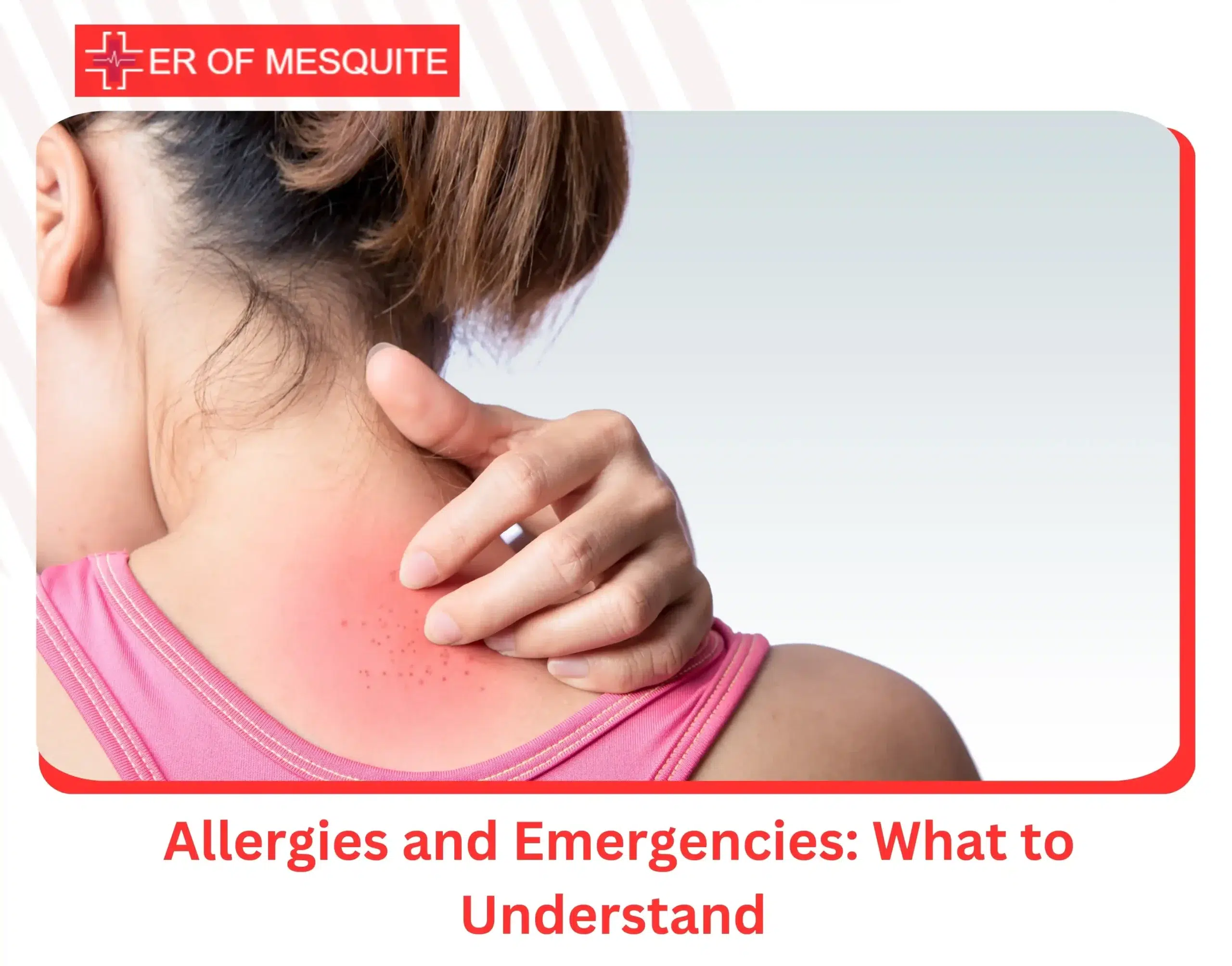 Allergies and Emergencies What to Understand