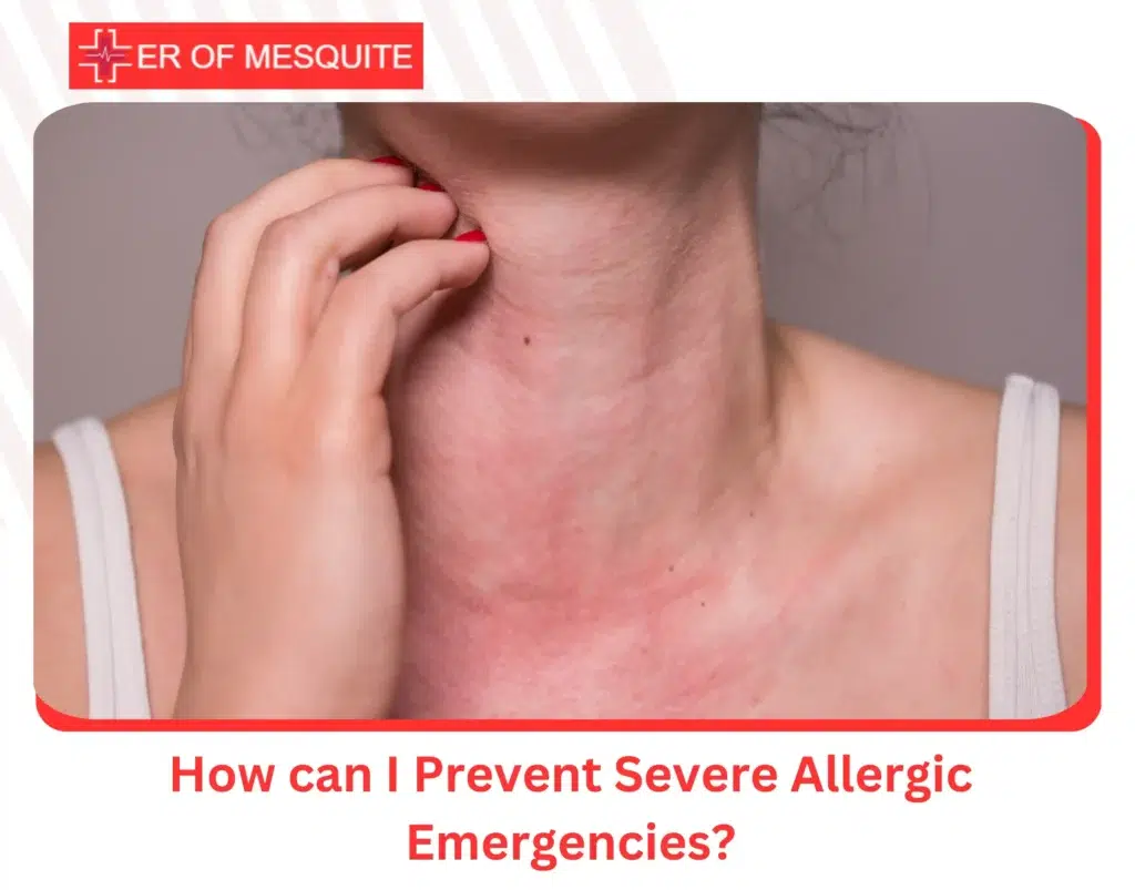 How can I Prevent Severe Allergic Emergencies