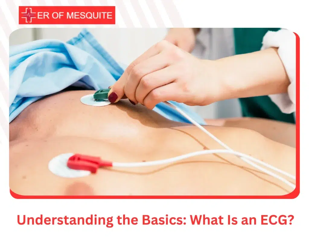 Understanding the Basics What Is an ECG