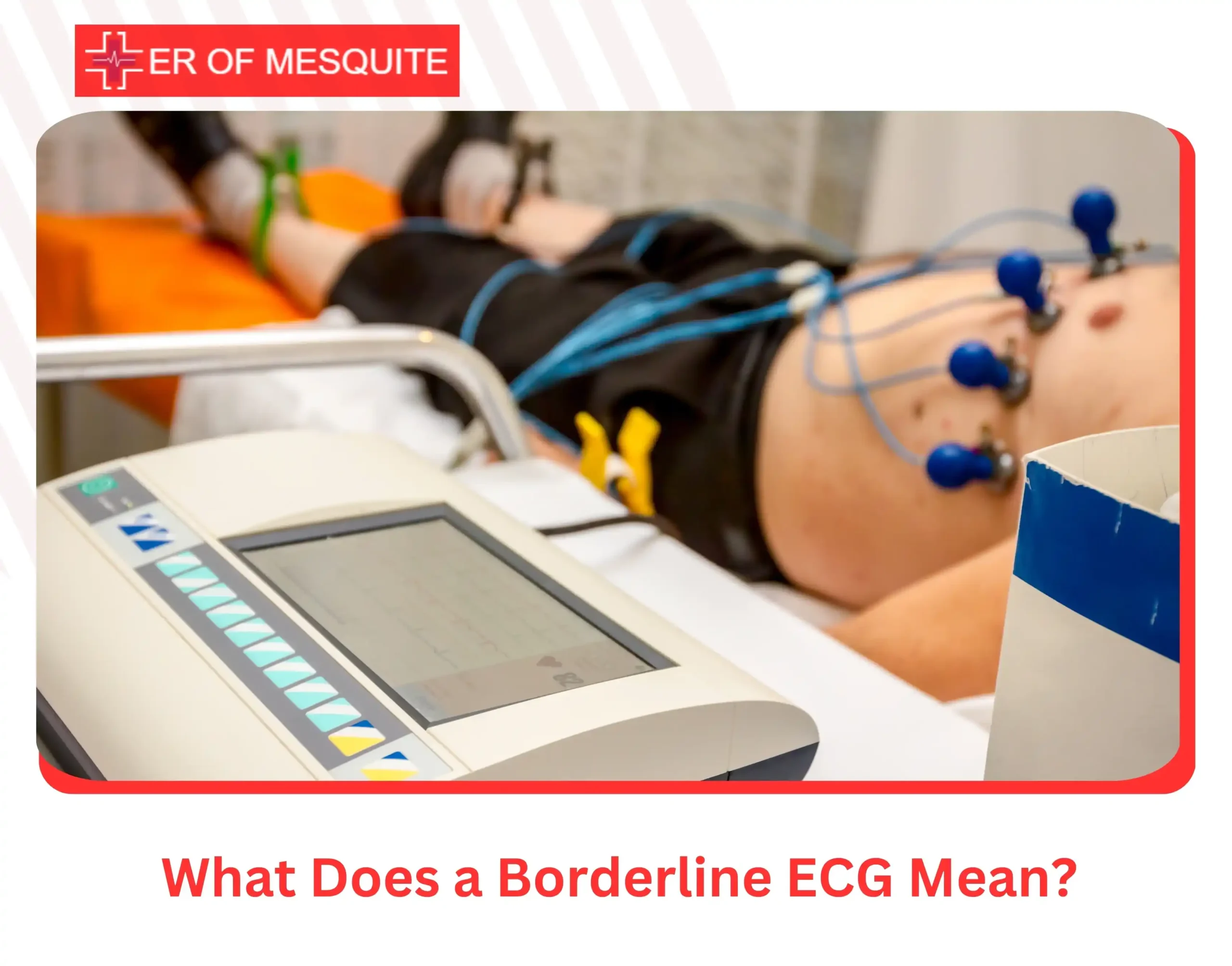 What Does a Borderline ECG Mean