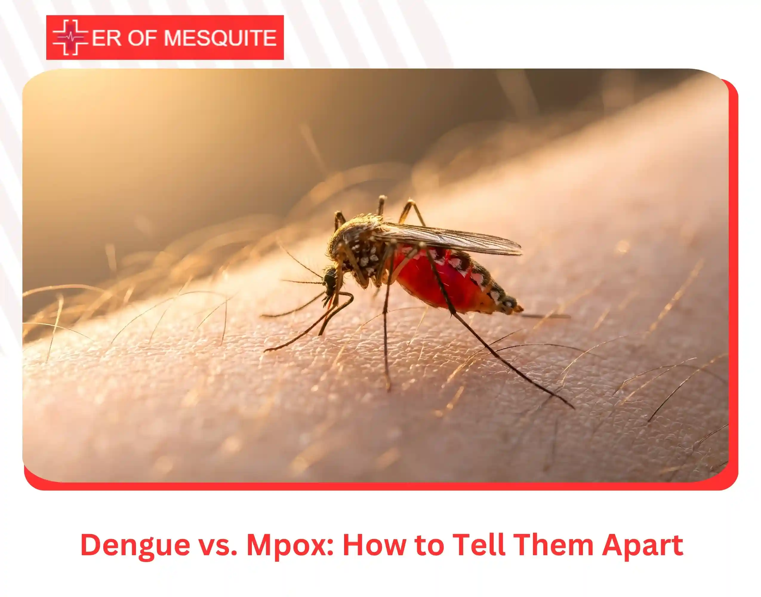 Dengue vs. Mpox How to Tell Them Apart